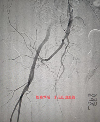 ˨Ӱ(f)(dng)}Ѫʧ