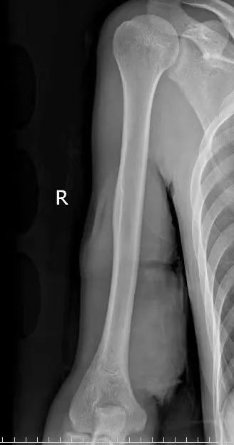 ģt(y)^(zhn)8Сrɹ֫!