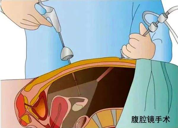 Â䲻У@A(dng)ĉ(mng)