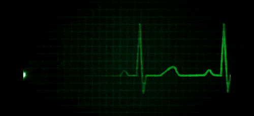 前一秒還在聊天,后一秒突然倒地,呼吸心跳驟停!幸好...... 前一秒還在聊天,后一秒突然倒地,呼吸心跳驟停!幸好......