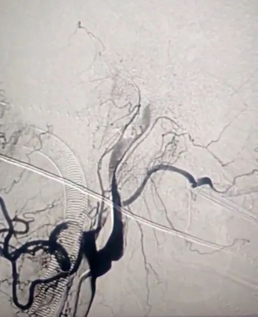 һͻȻ赹ڵԭ򾹺P(gun)