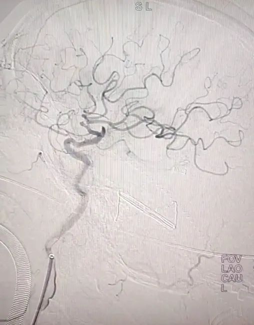 һͻȻ赹ڵԭ򾹺P(gun)