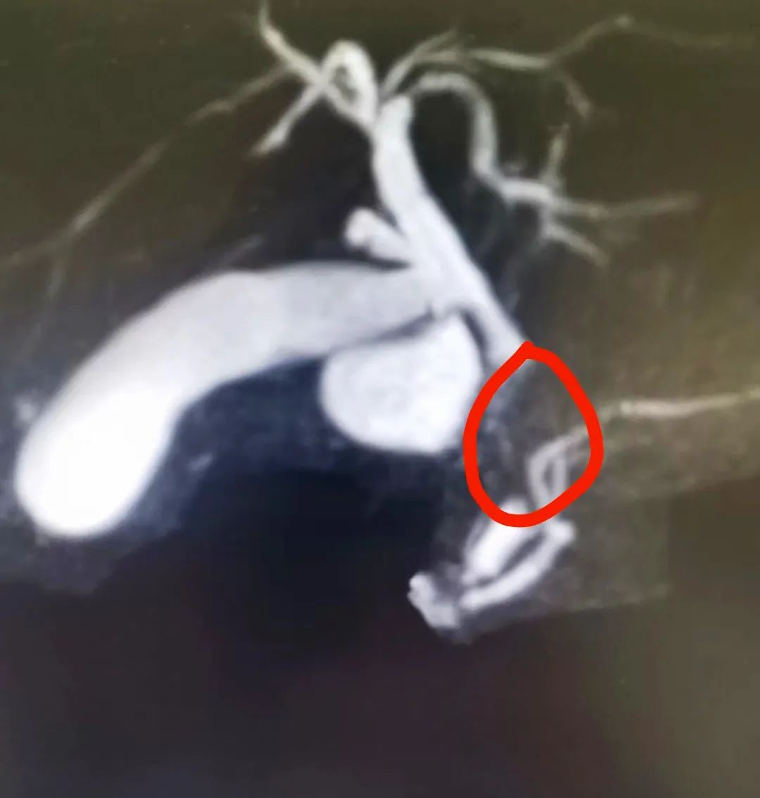 pRһλ׌đY(ji)ʯo(w)̎ѭ