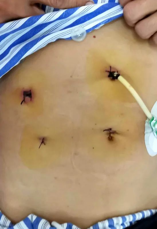 pRһλ׌đY(ji)ʯo(w)̎ѭ