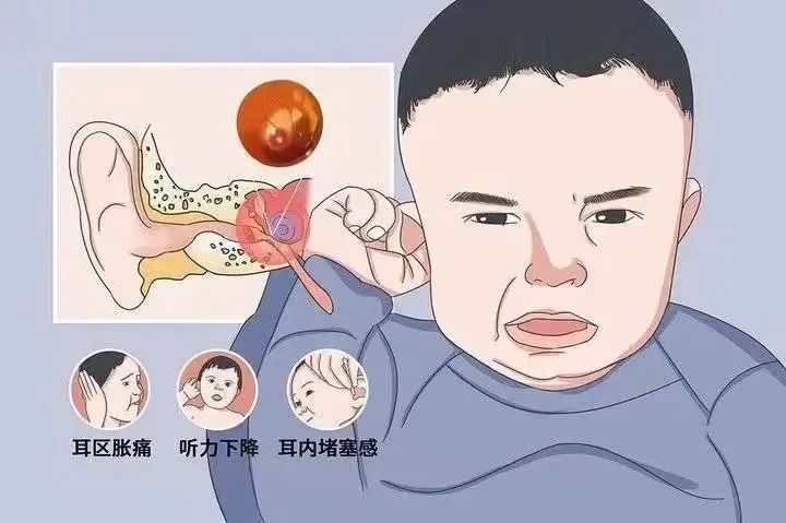 孩子感冒后易發(fā)這病,90%的家長(zhǎng)都會(huì)忽視這些癥狀! 孩子感冒后易發(fā)這病,90%的家長(zhǎng)都會(huì)忽視這些癥狀!