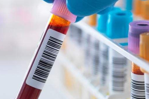 p˵(x)T׌c(din)סM(jn)ICU......