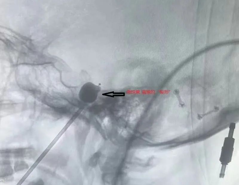 һ20Q_1֮õġµһʹ