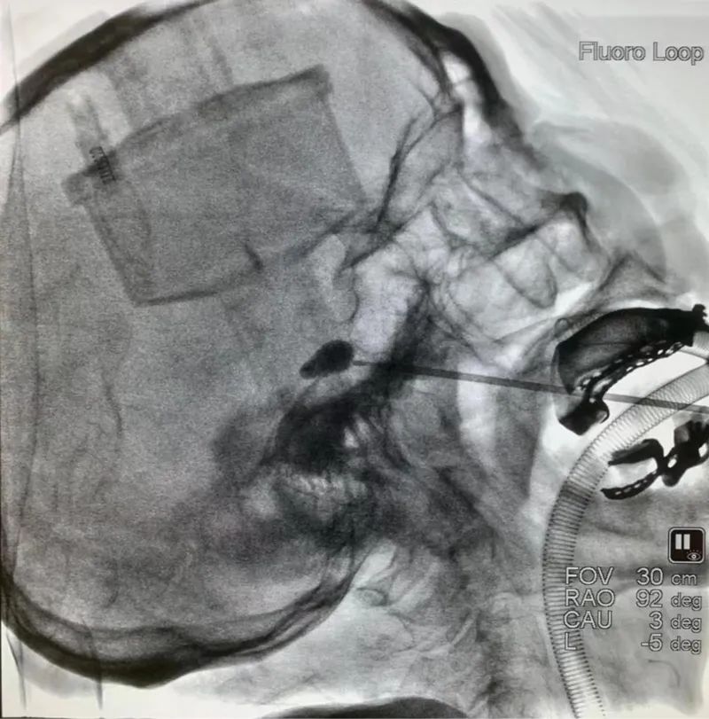 һ20Q_1֮õġµһʹ