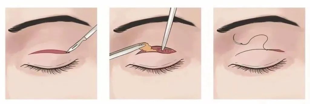 ԭpƤĘҲд乫ʽĘ͸mһNpƤ