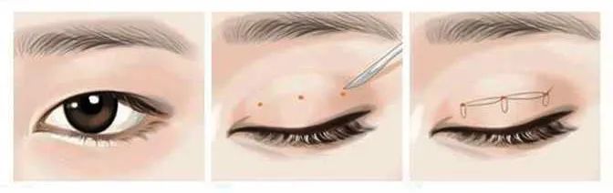 ԭpƤĘҲд乫ʽĘ͸mһNpƤ