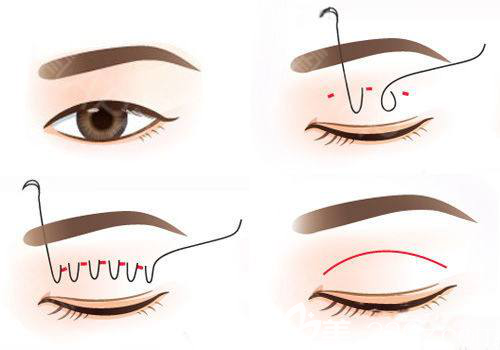 ԭpƤĘҲд乫ʽĘ͸mһNpƤ