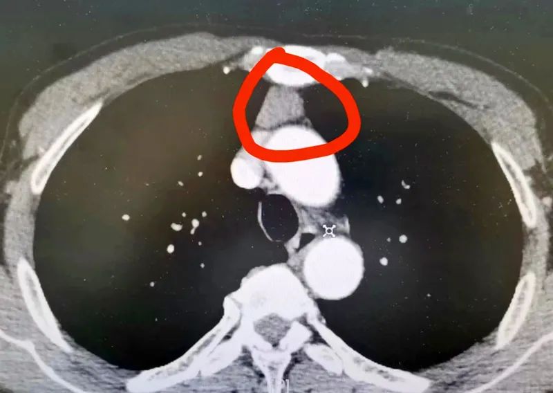 Ժl(f)F(xin)ǻ(ni)[һ(g)u[......