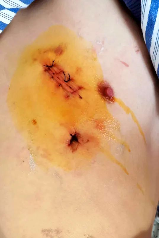 Ժl(f)F(xin)ǻ(ni)[һ(g)u[......