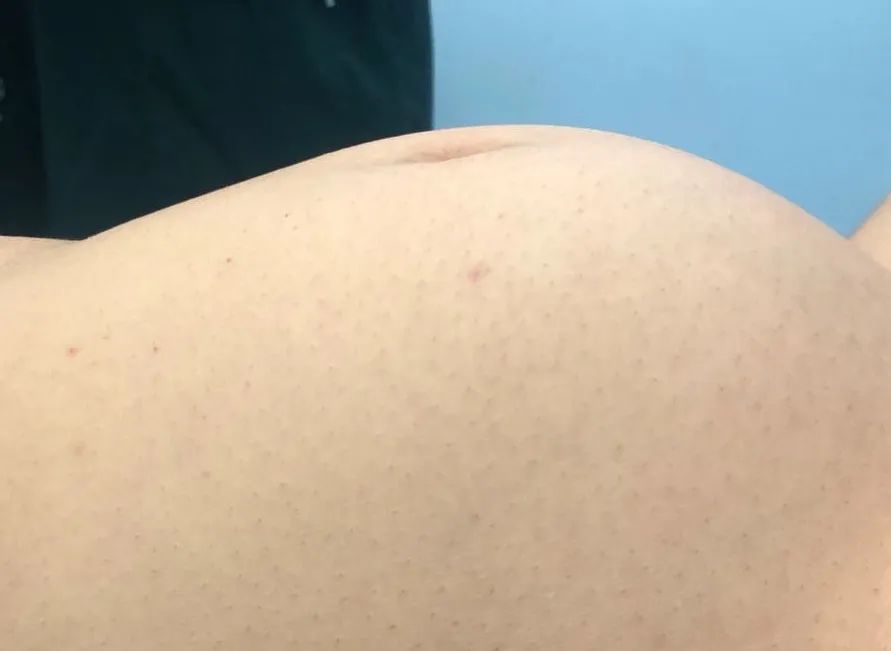 23qδδxgl(f)F(xin)ѡ̥