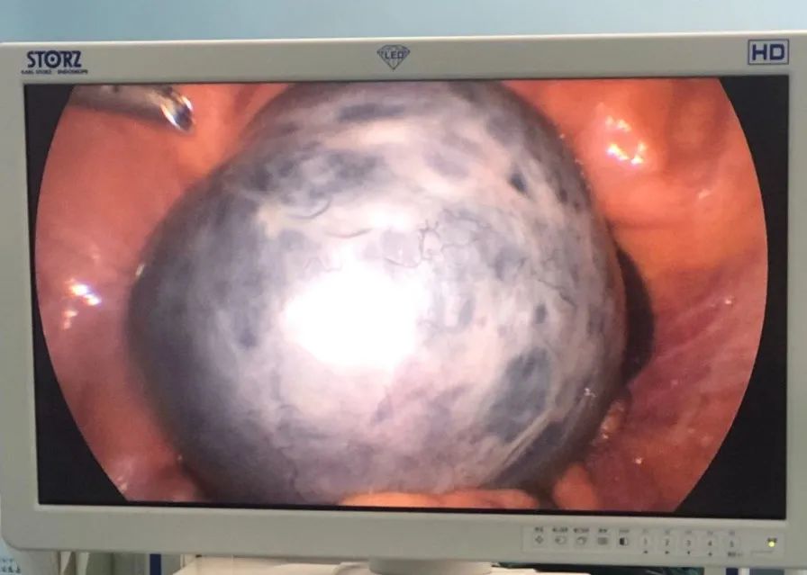 23qδδxgl(f)F(xin)ѡ̥