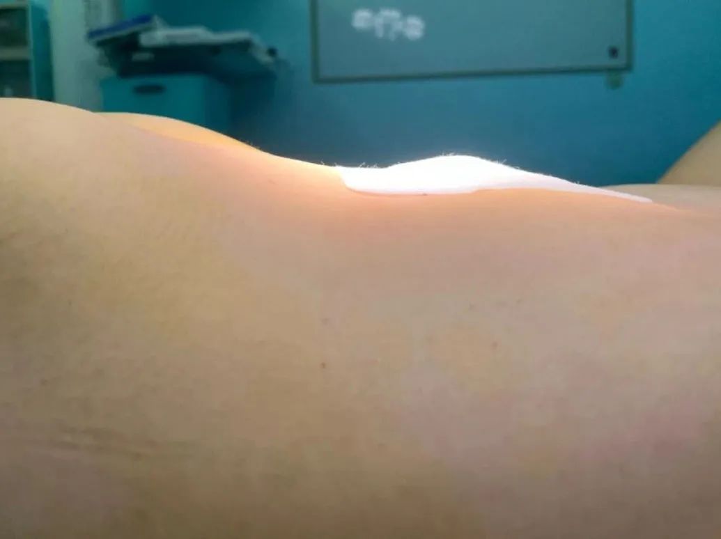 23qδδxgl(f)F(xin)ѡ̥