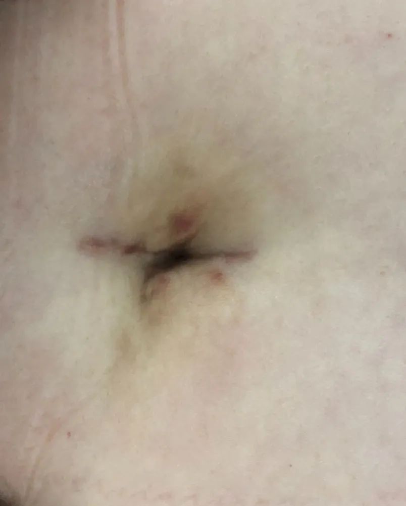 23qδδxgl(f)F(xin)ѡ̥