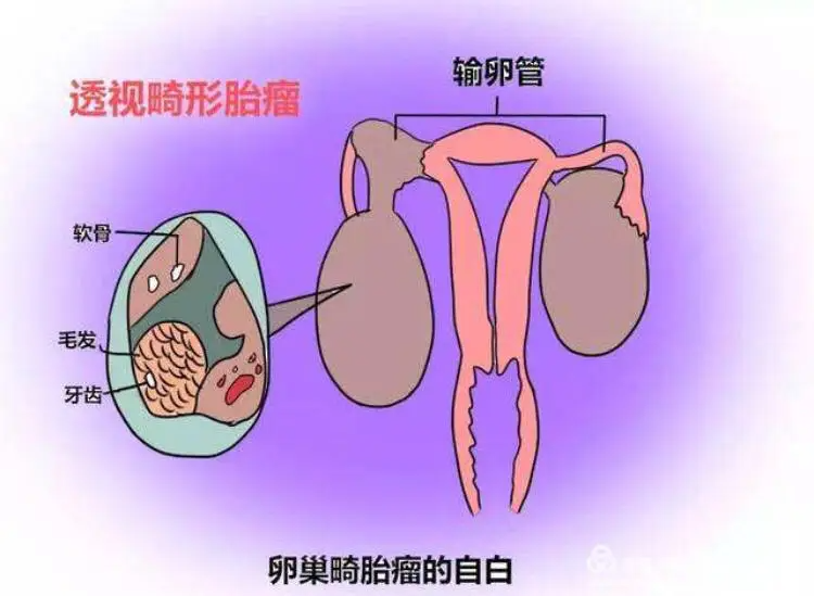 23qδδxgl(f)F(xin)ѡ̥