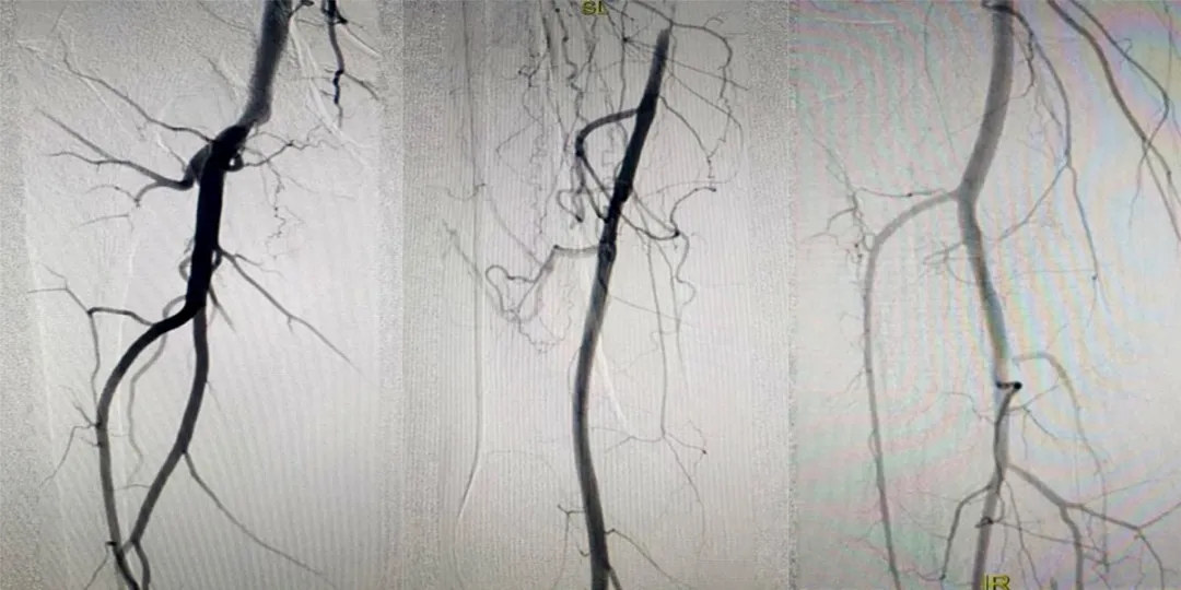 ֮ͨ·g(sh)׌Ĳٴpӯ