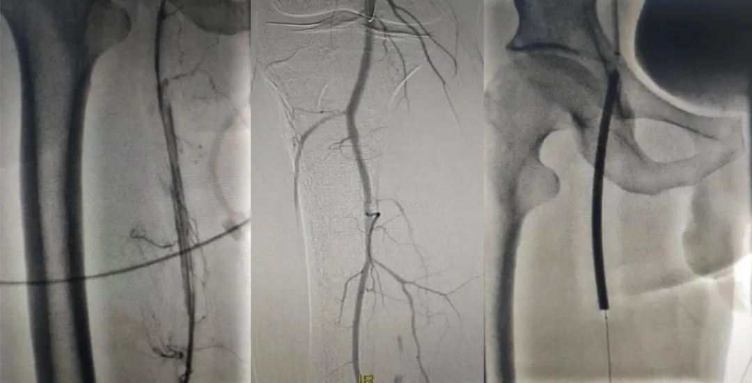 ֮ͨ·g(sh)׌Ĳٴpӯ