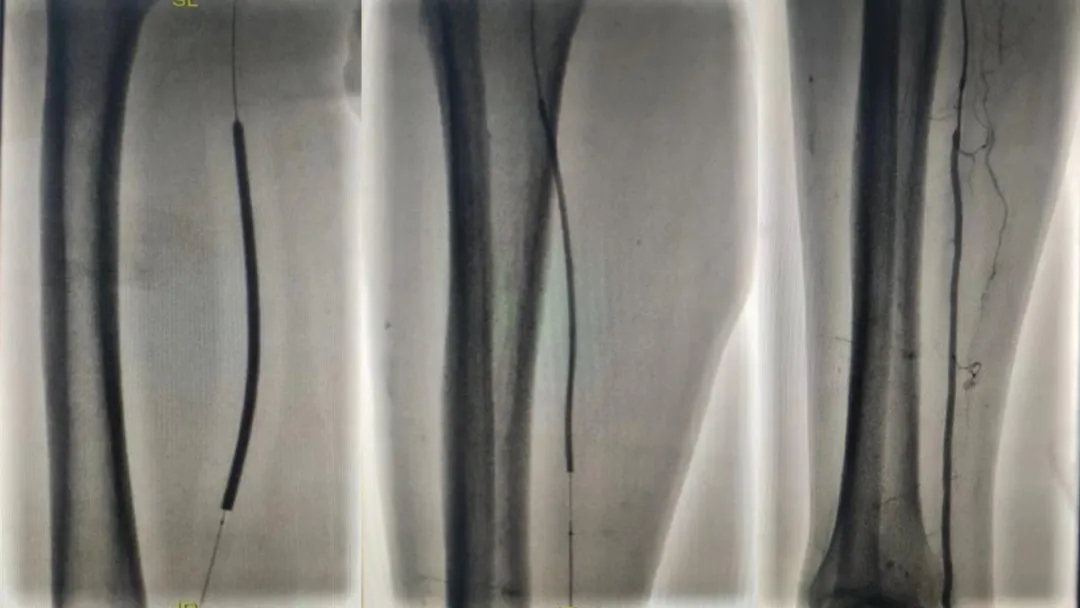 ֮ͨ·g(sh)׌Ĳٴpӯ