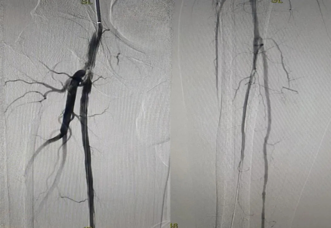 ֮ͨ·g(sh)׌Ĳٴpӯ