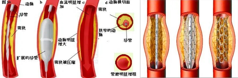 ֮ͨ·g(sh)׌Ĳٴpӯ