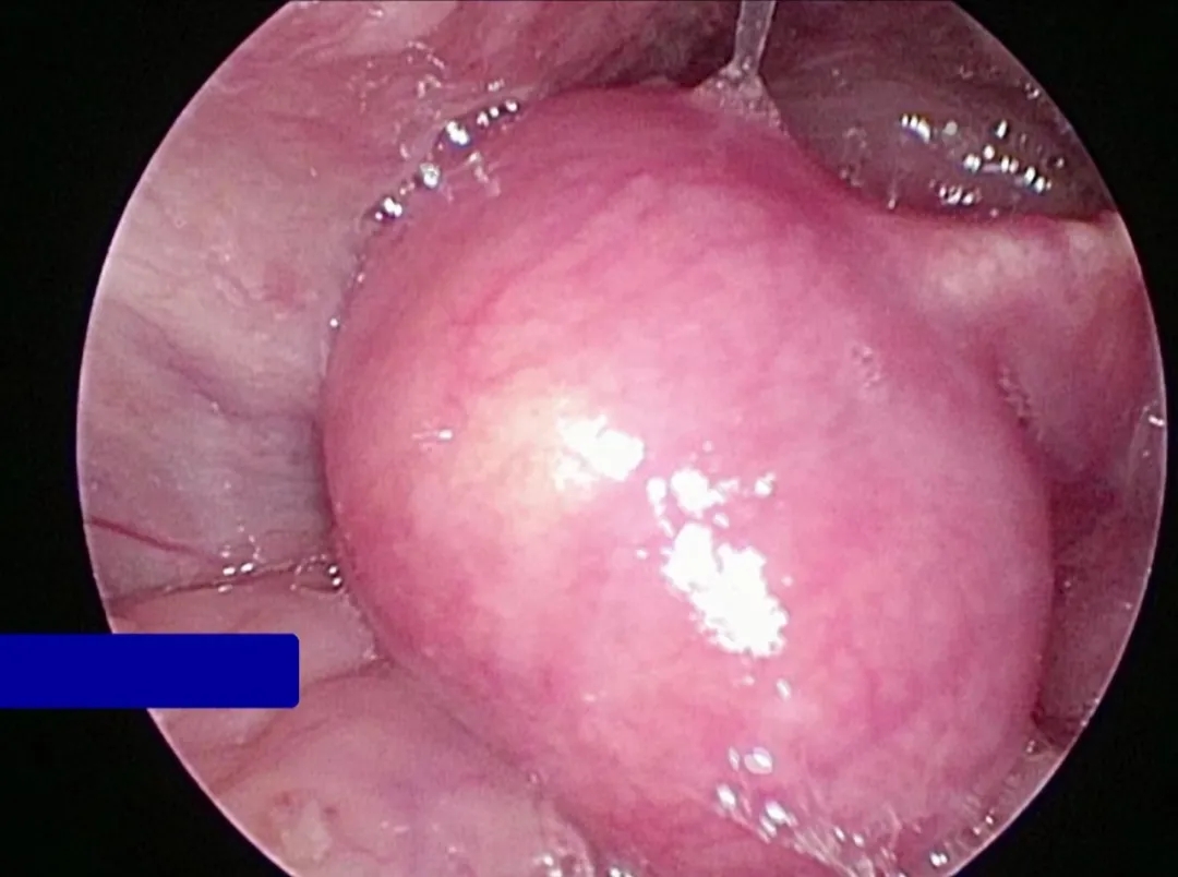 ʺвm@(g)Сһ