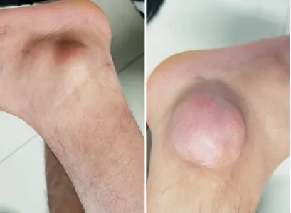 ôʹI(lng)ֻʹ^˲аl(f)ԙ(qun)