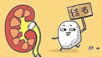 ССY(ji)ʯСUc(din)ᄳɴ!