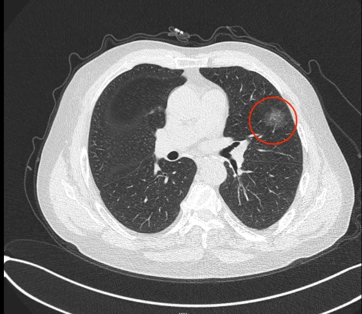 ڷCaġǡF(xin)t(y)@