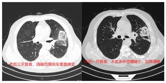 ڷCaġǡF(xin)t(y)@