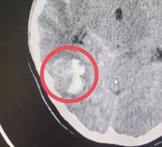 ^ʹXѪһ(g)13qŮ@ĚvU(xin)ӛl(f)ѣ