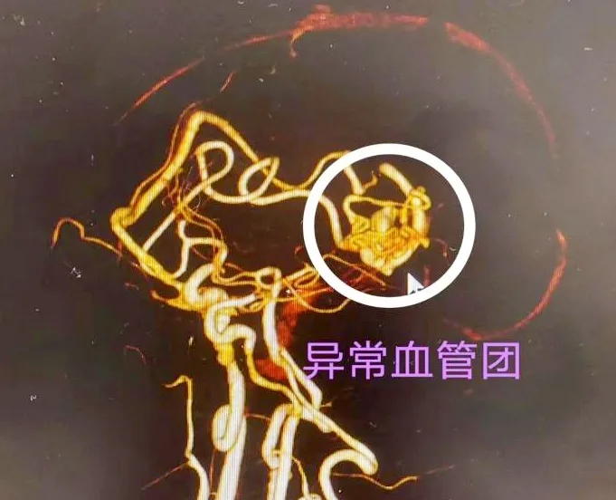 ^ʹXѪһ(g)13qŮ@ĚvU(xin)ӛl(f)ѣ