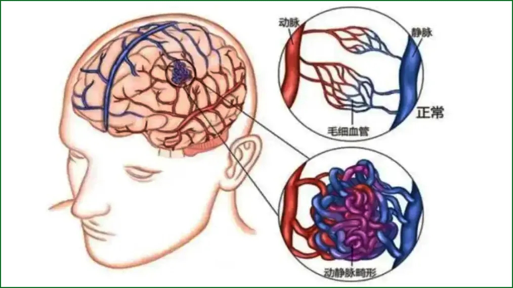 ^ʹXѪһ(g)13qŮ@ĚvU(xin)ӛl(f)