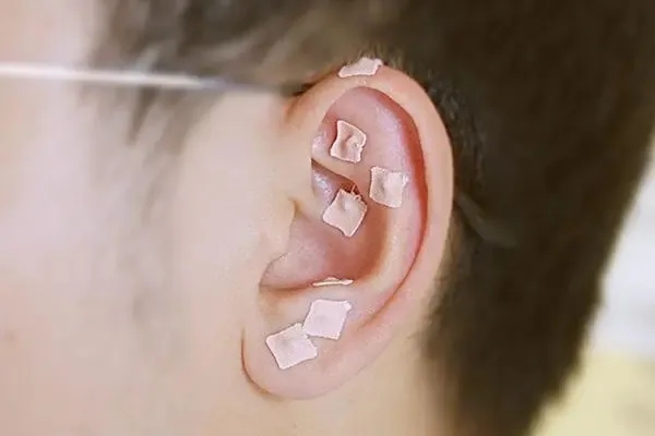 ׌ͻƿic(din)M(jn)͌(du)