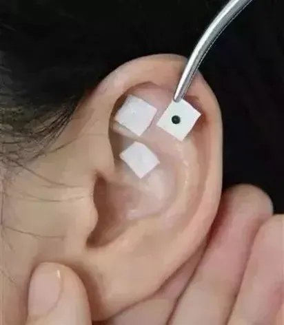 ׌ͻƿic(din)M(jn)͌(du)