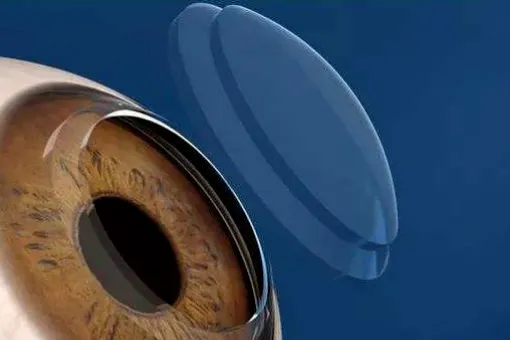 ˯ӾҕMչʲôڿƼ