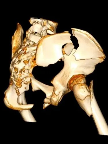 14q߿Չt(y)ԺȫIȱĹ