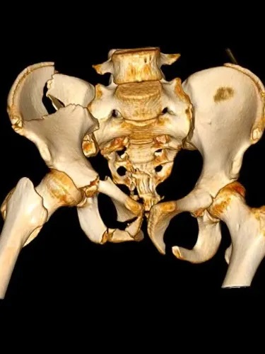 14q߿Չt(y)ԺȫIȱĹ