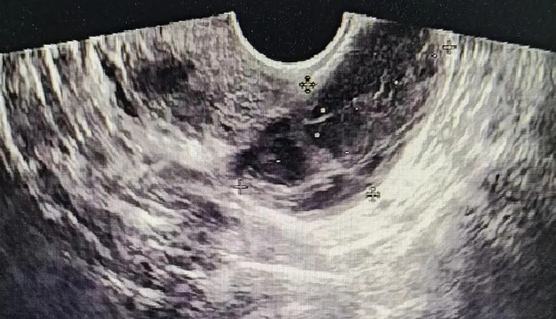 ŮԸʹԪSwѣ㲻ɲ֪