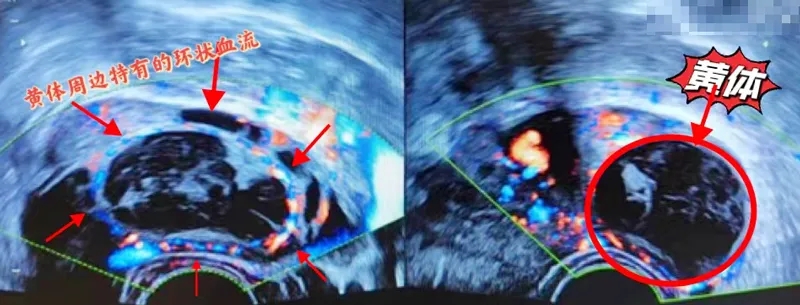 ŮԸʹԪSw㲻ɲ֪