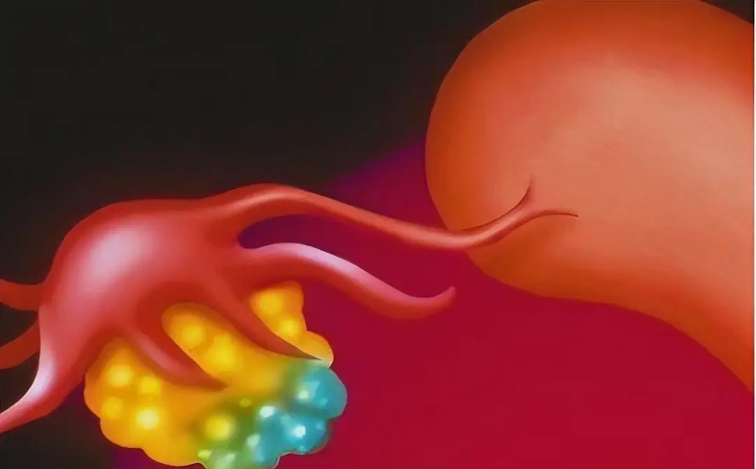 ŮԸʹԪSw㲻ɲ֪