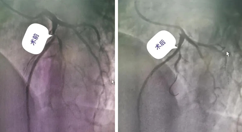 30qo(j)80qwĹp