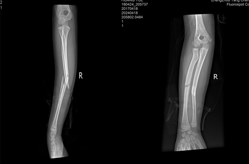 _Ҳg(sh)ίСܺӡһҪ