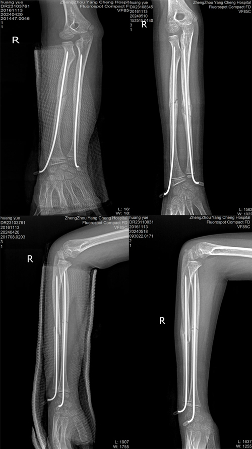 _Ҳg(sh)ίۣСܺӡһҪ