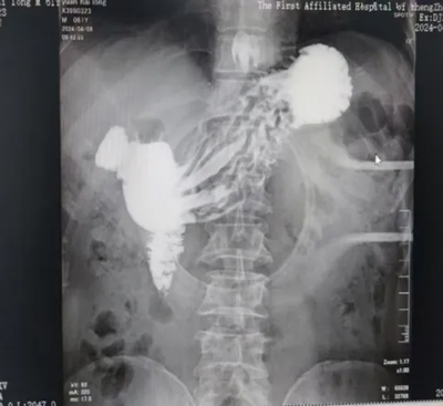 Ԟ顰θ(f)l(f)HhҪ(yn)