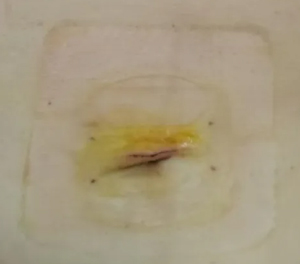 Ԟ顰θ(f)l(f)HhҪ(yn)أ