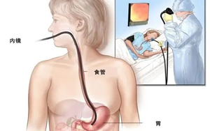 ζһDšθﾹȻL(zhng)ʯ^