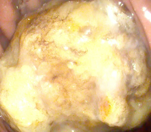 ζһDšθﾹȻL(zhng)ʯ^